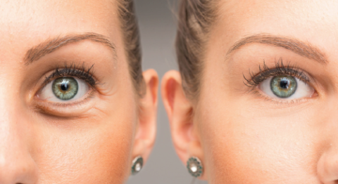 Was können wir gegen faltige Haut tun? - CaliVita ...